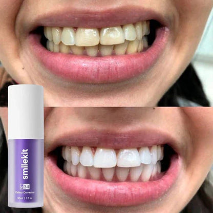 2X1 Blanqueador Dental Smile® | FORMULA AMERICANA| EL SECRETO DE KIM 😍